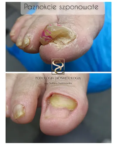 Gabinet Podologii i Kosmetologii mgr Svitlana Stasiorowska